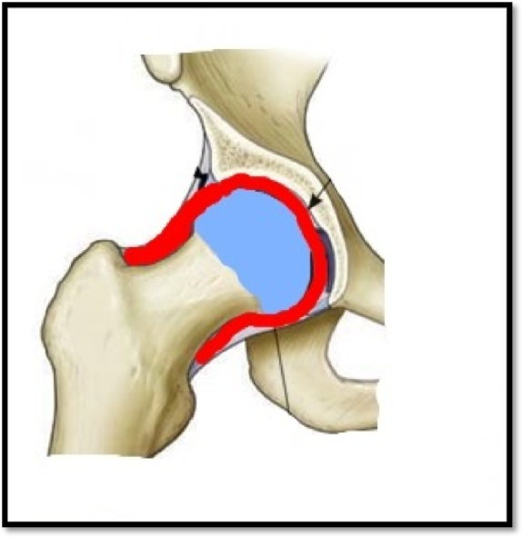 2. How do I know if I havesynovitis?